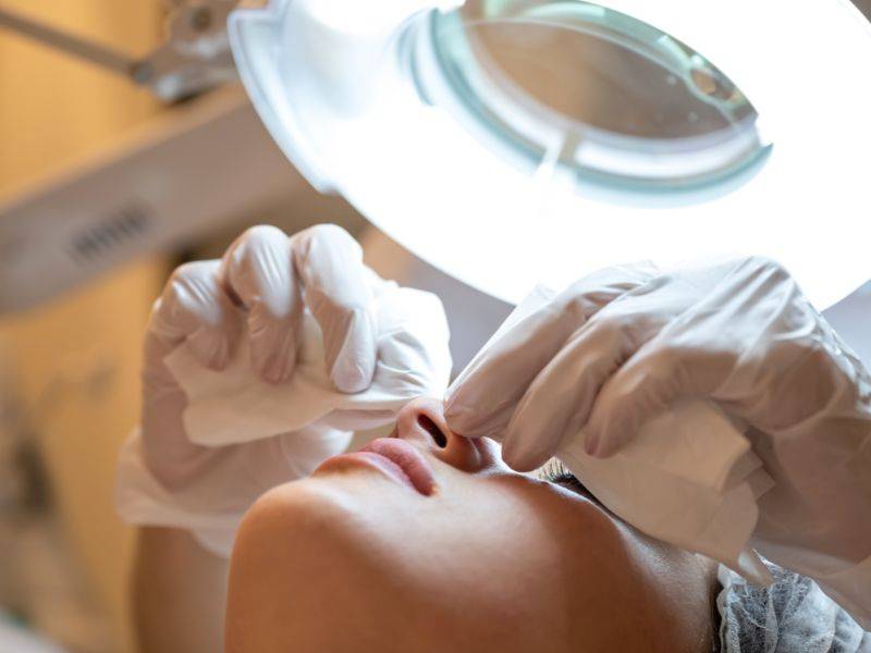 Limpieza facial profesional en Avenida de América, Madrid