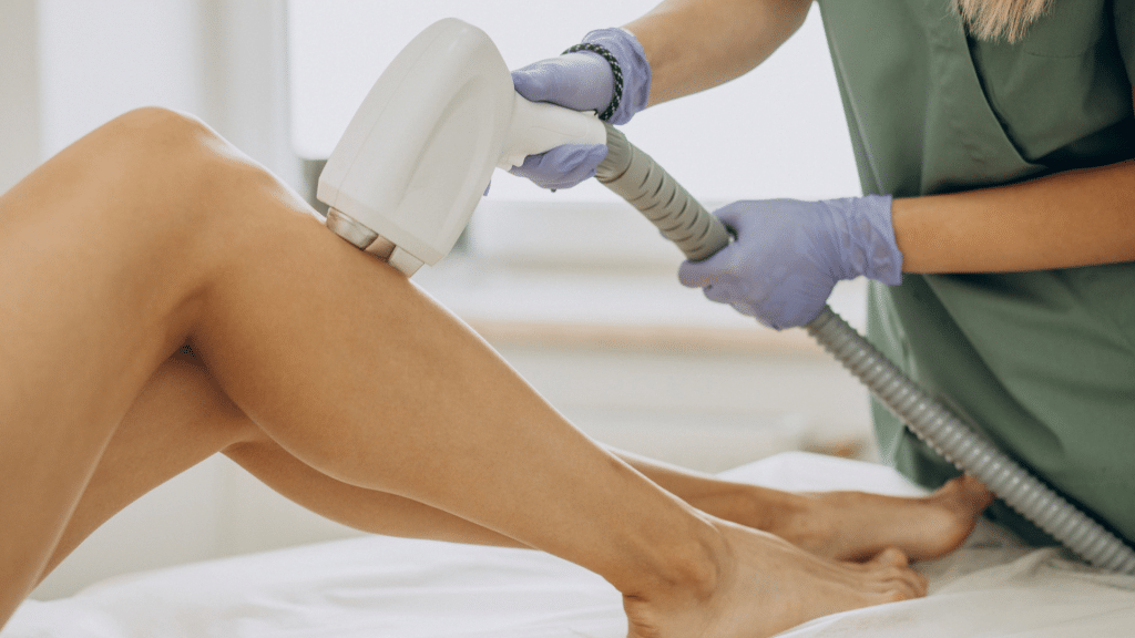 Depilación laser